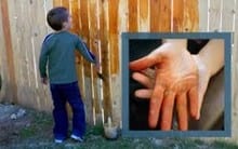 How To Remove Wood Stain From Skin